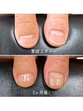 ネイルズ アヴァンティ(Nails Avanti)/自爪育成3ヶ月コース