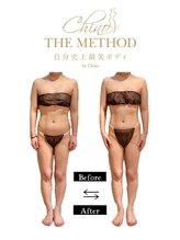 アンベリール(Embellir)/チノザメソッド施術1回