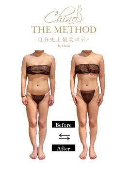 アンベリール(Embellir)/チノザメソッド施術1回