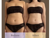 ボディのココチ 品川店(ボディのCOCOCHI)/30代前半女性☆Before/After