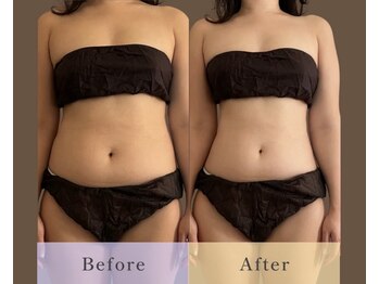 ボディのココチ 品川店(ボディのCOCOCHI)/30代前半女性☆Before/After