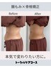 【トータルケアしたい方】内臓腸もみ＋腰＋肩甲骨＋骨格矯正（施術時間70分）