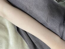 ナノハナ/鹿沼市全身脱毛美容室ナノハナ