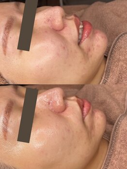 アフロディーテ/ララピール