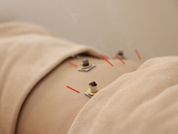 美鍼堂/自律神経と整える鍼灸