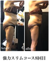 ピーラトゥ 日立(P-Ratu)/強力スリムコース