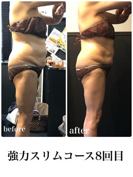 ピーラトゥ 日立(P-Ratu)/強力スリムコース