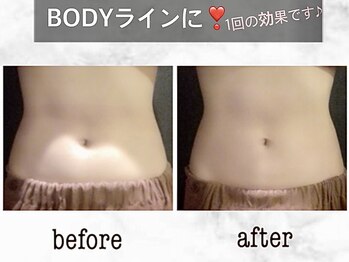 ナチュラーレ 京都四条烏丸店(Naturale)/リンパマッサージ痩身ダイエット