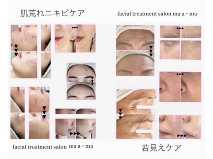 まぁ ま 西葛西店の写真
