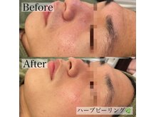 エステティックサロンRの雰囲気（【繰り返すニキビに終止符を】施術３回！肌荒れ・ニキビ・毛穴◎）