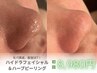 大人気毛穴洗浄◇ハイドラフェイシャル&ハーブピーリング◇最強セット!