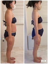 メロウプラス 錦糸町店/セルライトボディメイク