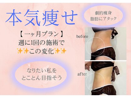 ミライ 福岡春日店(mirai)の写真