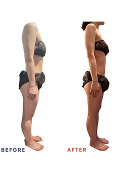 ベリップ 横浜店(Berip)/腕スッキリ