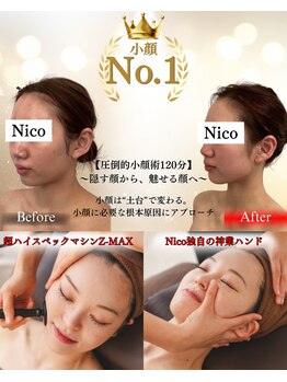 ニコ 岐南本店(Nico)の写真/[痩身/小顔専門店]だからできる"圧倒的結果出し"背中から始まる小顔術&マシン&濃厚コルギが『小顔を創る』
