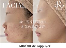 ミロワール ドゥ サピュイェ(MIROIR de Sappuyer)