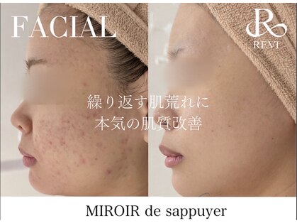 ミロワール ドゥ サピュイェ(MIROIR de Sappuyer)の写真