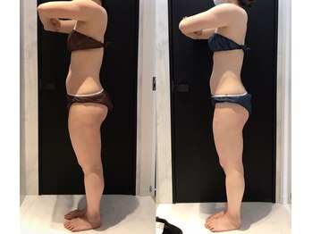 リボディ 表参道(An re Body)/before→after