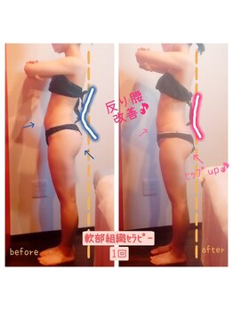 ビューティサロン キヨの部屋(beauty salon)/【軟部組織セラピー】 １回 