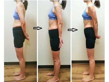 かんだ接骨院/48歳　骨盤ダイエット横面