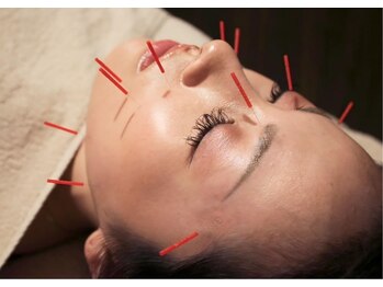 ここいろ/人気の美容鍼灸