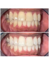 ライトビューティー 池袋店(LightBeauty)/将来写真