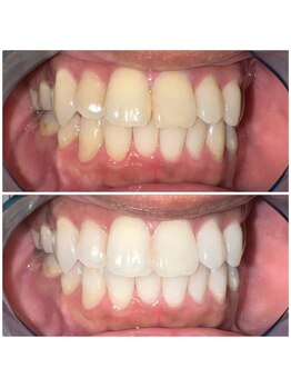 ライトビューティー 池袋店(LightBeauty)/将来写真