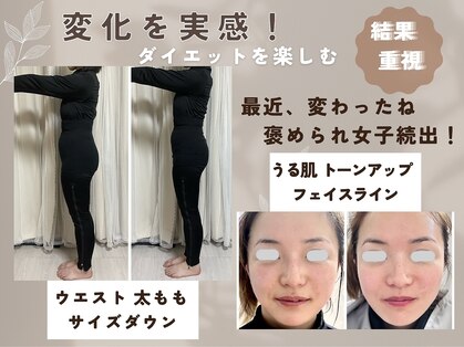 ヨサパーク エピス(YOSA PARK *epice)の写真