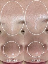 サロンドジェシカ(salon de Jessica)/プラズマ＋美肌フォト