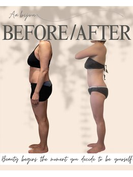 エイエービジュー(Aa.bijou)/