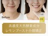 新製品★高コスパ【脂肪分解 レモンブースト】選べる3cc(お顔専用)