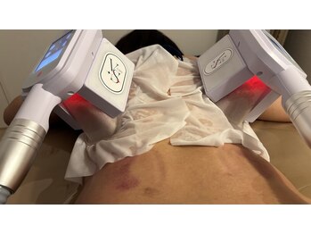 ヴィーナス(Venus)/脂肪冷却