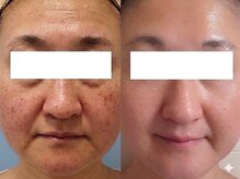 ブリスルーチェ(Bliss luce)