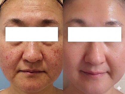 ブリスルーチェ(Bliss luce)の写真