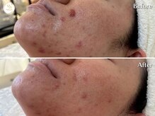 プリュボーテ 吉祥寺(Pul Beaute)の雰囲気（肌の土台を育て、繰り返す肌トラブルを根本から改善します）