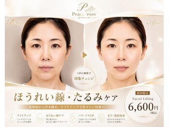 ピーチ ローズ(peach rose)の写真/まぶたが重く感じる方へ。ぱっちりとした目元印象を目指すケア