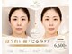 ピーチ ローズ(peach rose)の写真/まぶたが重く感じる方へ。ぱっちりとした目元印象を目指すケア