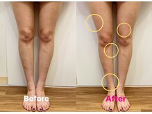 エクルビューティーツー(ECRU Beauty 2)/フォースカッター美脚