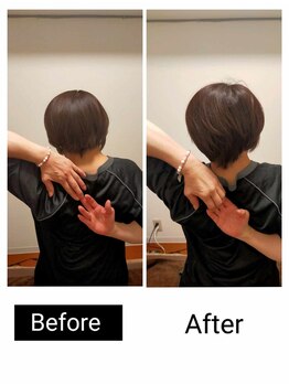 アース エンジェル整体院/ビフォアフ 肩甲骨はがし