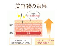 ゲンキ鍼灸整骨院(Genki鍼灸整骨院)/美容鍼の効果