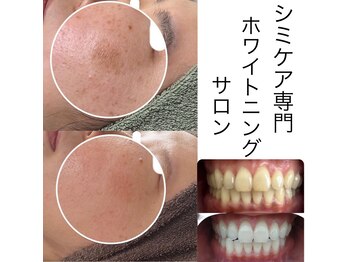 プライベートサロン プース(pousse)