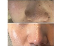 ブランスパ(Bulan Spa)/オーナーの１年の結果