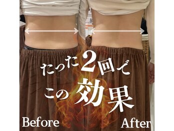 ラフィール/感動症例：メンズも歓迎