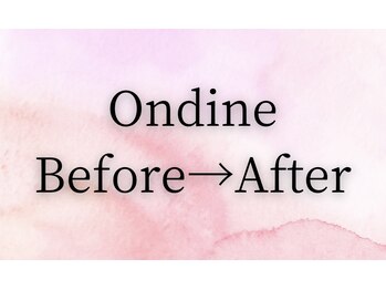 オンディーヌ 名古屋/お客様結果！！