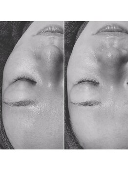 ロッカ(ROCCA..)/フェイシャルWaxトリートメント