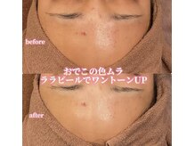 アクトベレッザ(Act BELLEZZA)/乾燥日焼けの色ムラにララピール