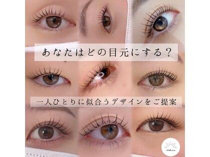 ウェリナ(Welina)の写真