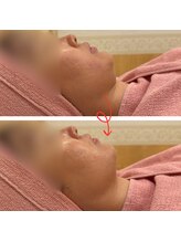 ジュノ メディカルエステティックサロン 栄店/お客様B&A