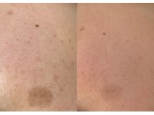 モガナ(mogana)/濃い悩みも相性ぴったり