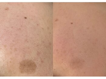 モガナ(mogana)/濃い悩みも相性ぴったり